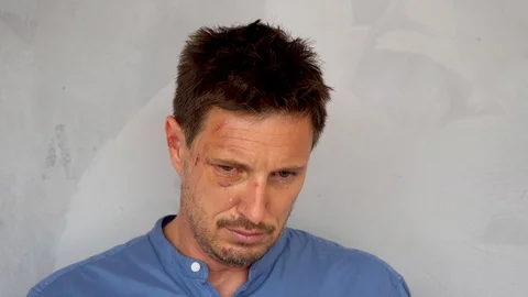 A close up of a bruised man crying Stock Footage 109687810