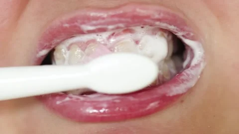 Close-up of brushing teeth with foam and toothbrush Stock Footage 340261334