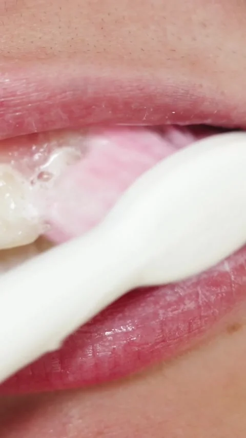 Close-up of brushing teeth with pink toothbrush and white foam Stock-Footage 343838161