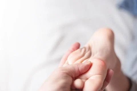 Close up of calluses. Problem skin on the steps of a teenager Stock Photos