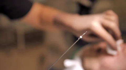 Close-up of cannula ready for Thread Lifting, Doctors hand on a blurred Stock Footage 124320317