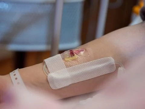 Close up of a canula inserted into a patient's arm Stock Photos