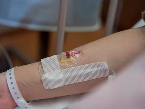 Close up of a canula inserted into a patient's arm Foto stock