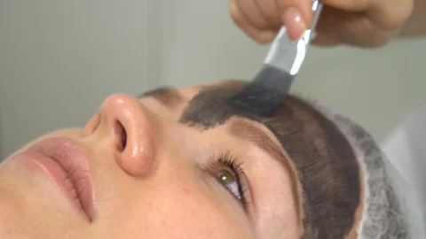 Close-up carbon face peeling procedure. Laser pulses clean skin of the face Stock Footage 129531601