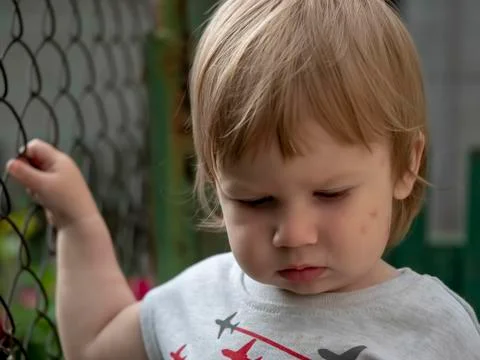 Close-up of a child with a bitten face Stock Photos