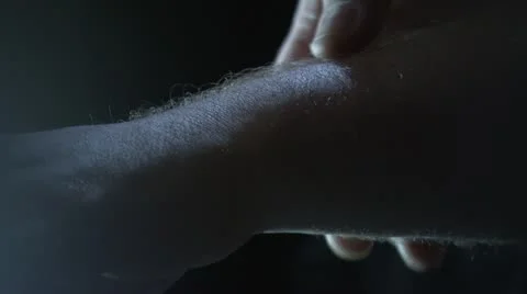 Close up of clamp being applied to arm Stock Footage 20448799