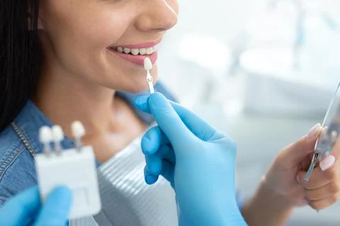 Close up of client choosing tooth implants with doctor in hospital Stock Photos