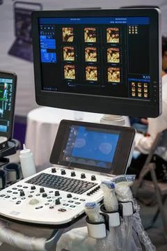 Close-up of the control computer of the multifunctional medical equipment 스톡 사진