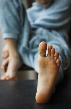 Close-up of a corn patch stuck to the big toe of a Caucasian school-age boy Stock Photos