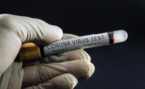 Close up of Corona virus lab test tube in doctor's hand. Фото