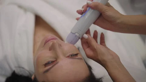 Close-up of cosmetologist applying microneedle device to middle-aged woman face Stock Footage 321058238