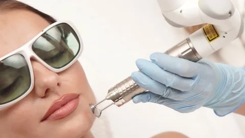 Close-up of cosmetologist arm using erbium laser on woman face Stock Footage 143162799