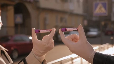 Close-up of couple in gloves holding ampoules with a blood test for coronavirus. Stock Footage 128317900