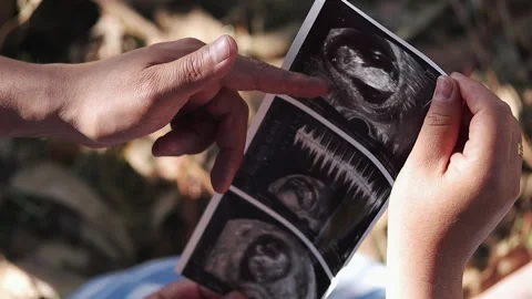 Close-up of a couple's hands looking at an ultrasound of their baby. Stock Footage 225583682