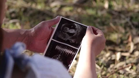 Close-up of a couple's hands looking at an ultrasound of their baby. Видео 225587033