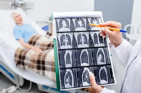 Close-up CT lung screening. Diagnostics and treatment of patients with pneumo Stockfoto's