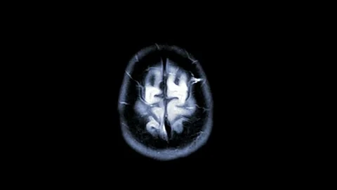 Close up of CT scan of brain anatomy health science hospital medical medicine Stock Footage 336561201