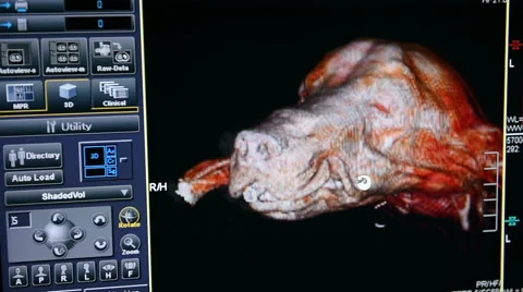 Close up of CT scan computer Stock Footage 44276549