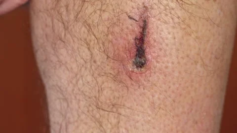 Close-up of a cut on an elderly man's leg in slow motion. Stock Footage 332234663