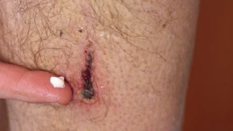 Close-up of a cut on an elderly man's leg in slow motion. Stock Footage 332234788