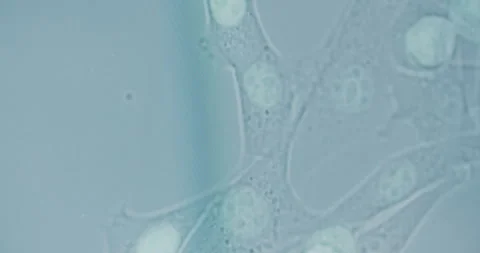 Close-Up of Dangerous Bacteria Under Microscope Stock Footage 318597468