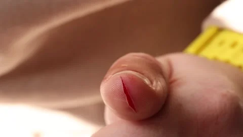 Close-up of a deep cut on fingertip. Fresh wound with blood shows Stock Footage 292245763