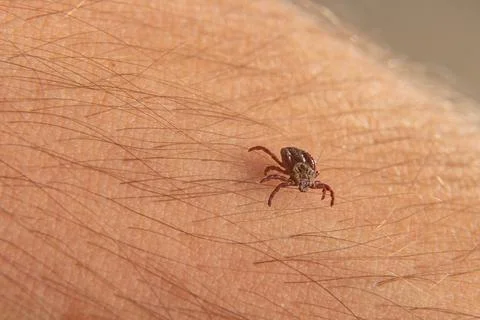 Close-up deer tick trying to bite through human skin. Danger Infection through Stock Photos