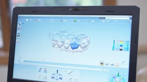 Close up of dental crown being designed on digital design software Stock Footage 113714464