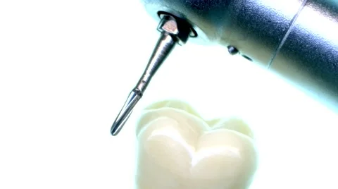 Close-up of dental drill, also called high-speed handpiece, and tooth. Stock Footage 46911180