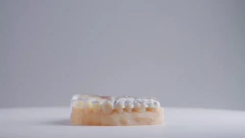 Close-up of dental model with orthodontic braces on white background. Teeth Stock Footage 336059313
