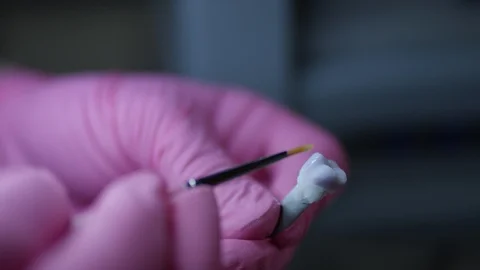 Close up of dental professional working on tooth replacement 動画素材 113705171