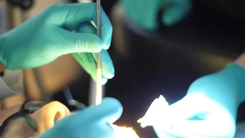 Close Up Dental Tools Stock Footage 86579705