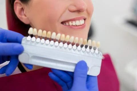 Close up of dentist checking the level of teeth whitening for young woman Stock Photos