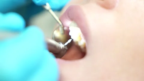 Close-up of dentist hands who is learning to treat teeth on human head mannequin Stock Footage 263579224