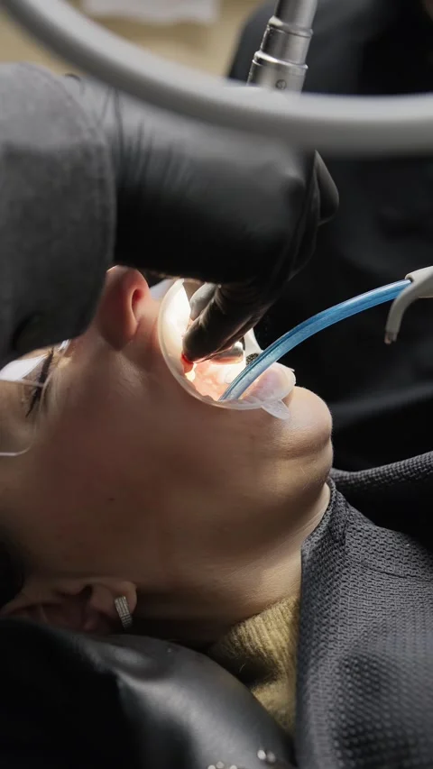Close-up of dentist reshaping enamel for crown placement. Precision dental Stock Footage 341704881