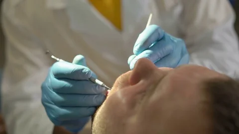 Close-Up of Dentist Using Dental Tool And Mirror Conducts the Restoration of the Stock Footage 76557653