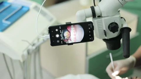 Close-up of a dentist using microscope. Modern equipment microscope in dental Stock Footage 194461359