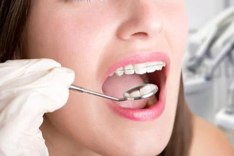 Close-Up of a Dentist at Work Stock Photos