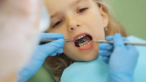 Close-up of the dentists hand treating teeth of a little girl in clinic. Stock Footage 317171143