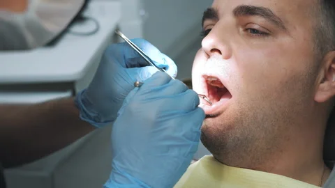 Close-up of the dentists hand treating teeth of a man in clinic. Stock Footage 317296383