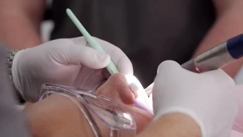 Close-up of dentist's hands in gloves treating patient's teeth in modern dental Stock Footage 261827526