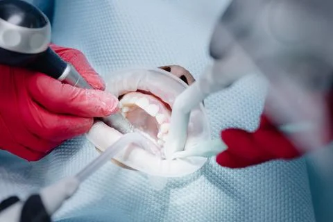 Close up of dentists hands in the process of brushing female patient's teeth Stock Photos