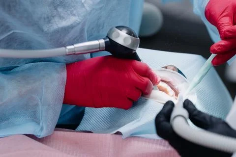 Close up of dentists hands in the process of brushing female patient's teeth Stock Photos