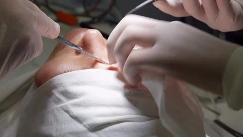 Close up detail of a surgery of the eye. Stock-Footage 263579209