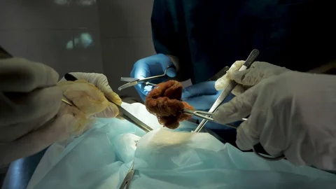 Close up detail of a surgery Stock Footage 106670983