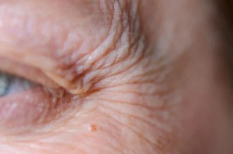 Close-up details of the crows feet and wrinkled skin around the eye. Stock Photos