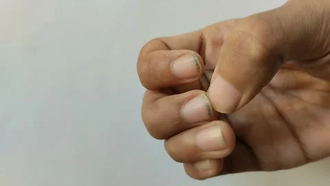 Close up of dirty nails on white background Stock Footage 289923141