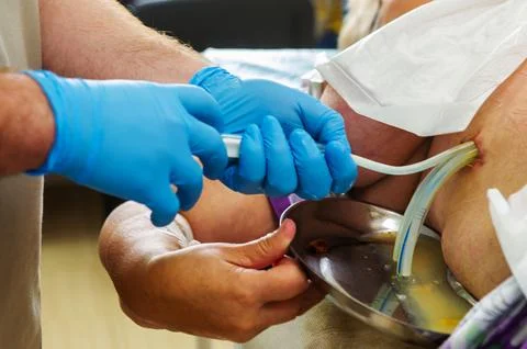 Close up of doctor hand while surgeon and assistant performing surgery on Stock Photos