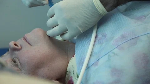Close-up. The doctor makes a puncture of the thyroid gland using ultrasound Stock Footage 94763677