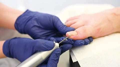 Close-up - a doctor or a pedicure master treats the patient's nails with a Stock-Footage 152155553